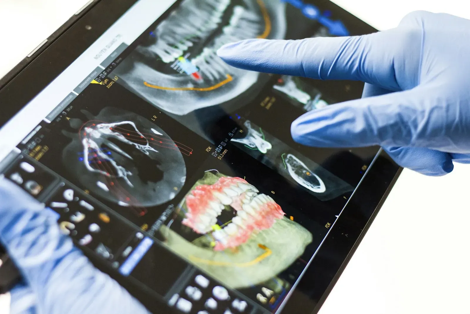 Tecnología Dental Digital 3D